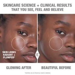 COLLAGEN SUPERFUSION FACIAL OIL -SEP Beauty Shop CollagenOil Model Before After Deep 3