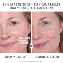 COLLAGEN SUPERFUSION FACIAL OIL -SEP Beauty Shop CollagenOil Model Before After Fair 3