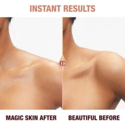 CHARLOTTE’S MAGIC CREAM FACE & BODY TRAVEL DUO -SEP Beauty Shop MagicBodyCream BeforeAndAfter Medium Shoulder